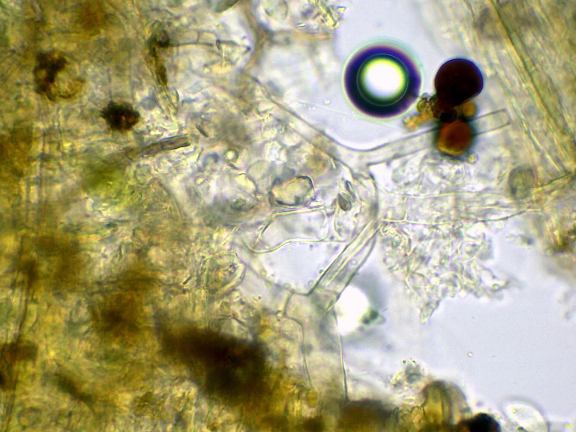 Microscopía de Ceratobasidium cornigerum - 11 - Hifas Melzer-001